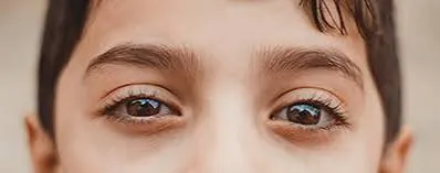 Lazy Eye (Amblyopia)